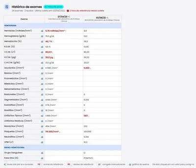 Tabela de histórico de exames com hemograma e imuno-hematologia, duas coletas de laboratórios diferentes lado a lado e valores fora da referência em vermelho